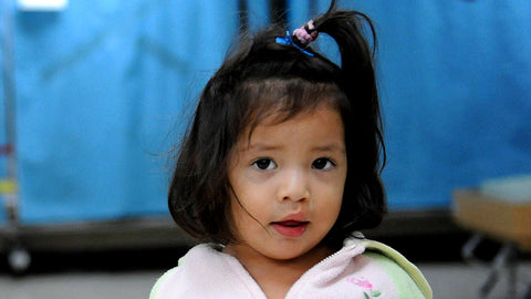 Treatment of Cleft Lip & Palate Treatment