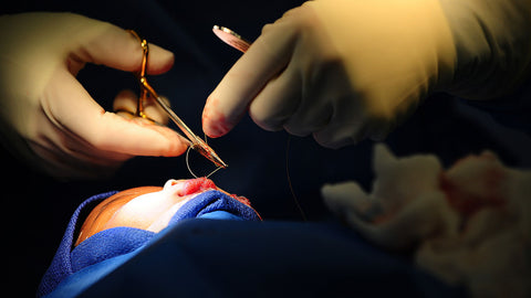 Rhinoplasty In The Cleft Lip & Palate Patient