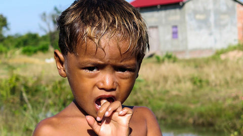 Contract Conditions To Look For When Nursing Overseas