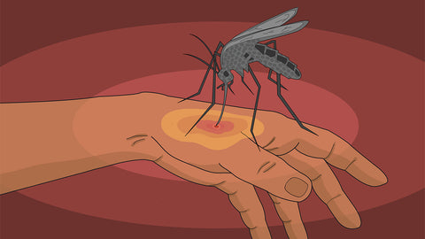 Making Sense of Third World Countries’ Zika Virus Outbreak
