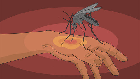 Making Sense of Third World Countries’ Zika Virus Outbreak